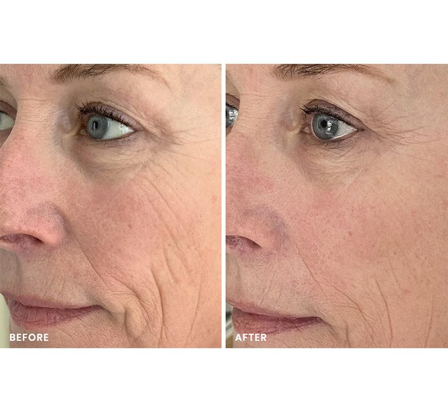 8 MINUTE MASK - Image 12
