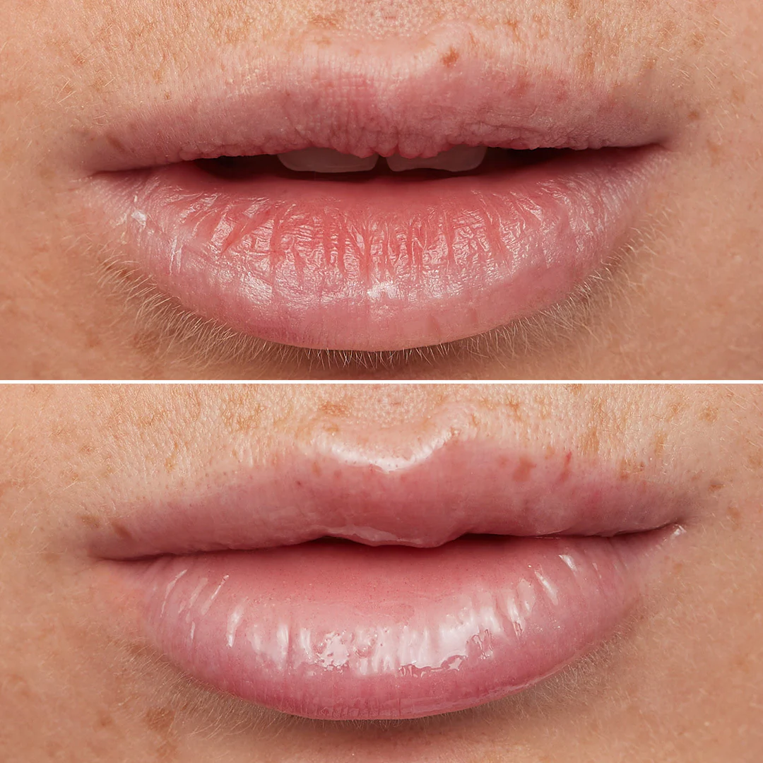 Lip Rehab Serum Oil - Image 11
